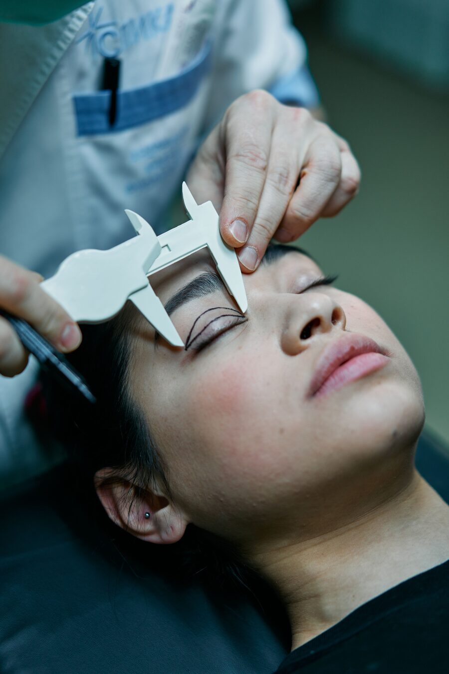 Eyelid measurements being marked out during a consultation (stock photo for illustration)
